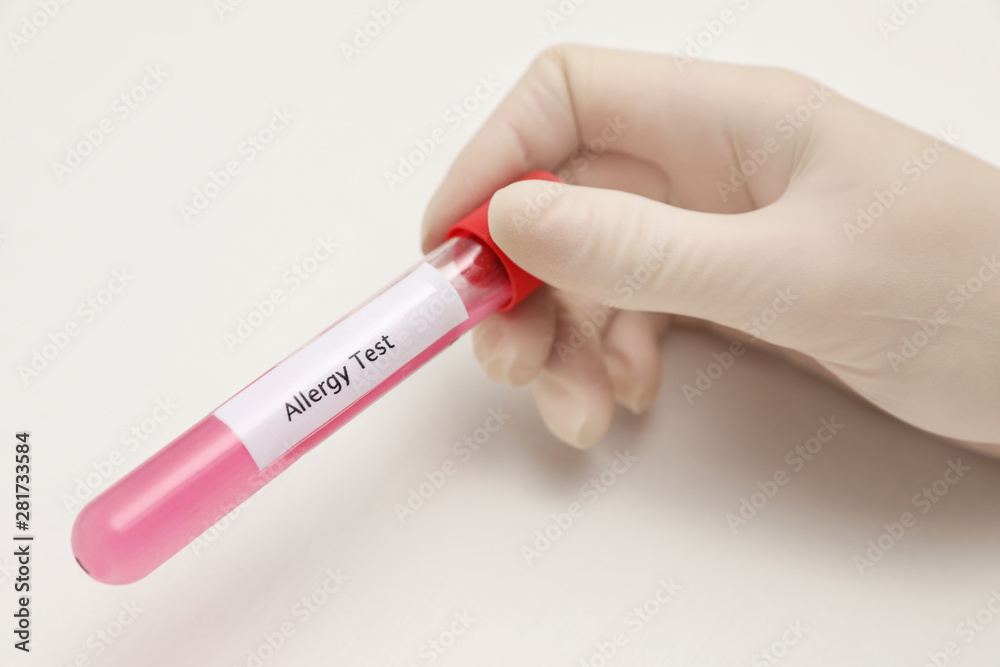 Naklejka premium Doctor holding tube with label ALLERGY TEST on light background, closeup