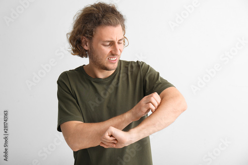 Young man with skin allergy on light background photo