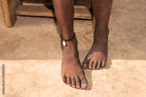 Africa, African, black, grigri, gris gris, grigris, gri-gri, gris-gris, talisman, child, kid, boy, people, person, five, years, ankle, feet, foot, amulet, protect, protection, luck, lucky, superstitio photo