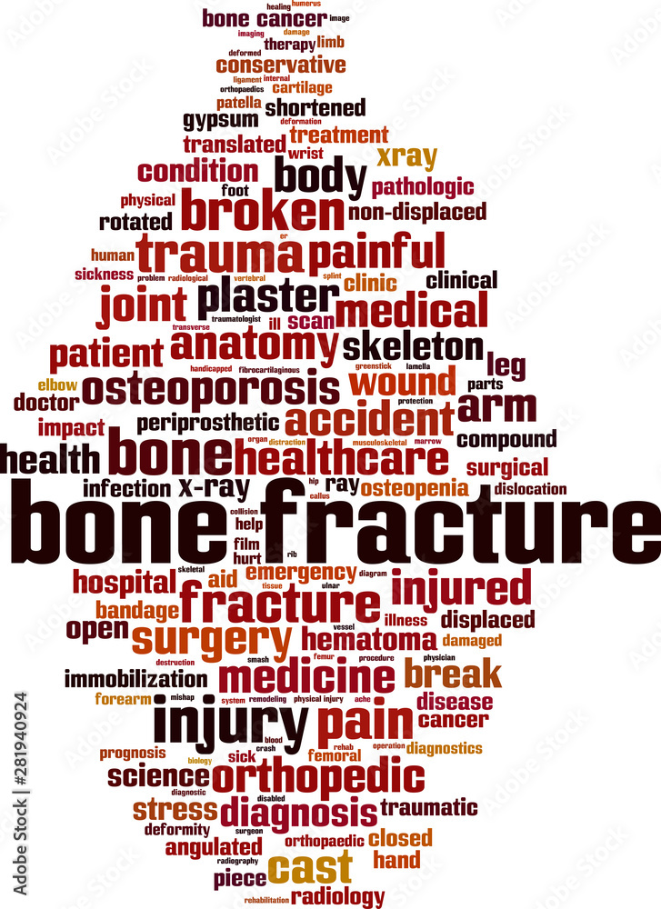 Obraz premium Bone fracture word cloud