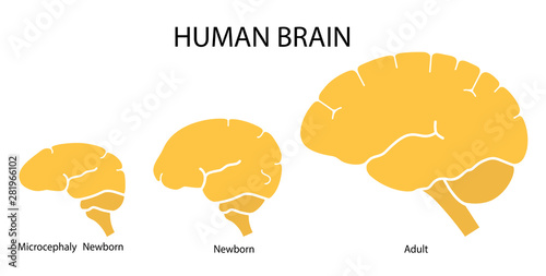 Silhouette image of human brain adult, newborn child with a normal brain and severe microcephaly. Virus of Zika. Vector. Flat design