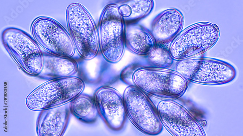Microscopic image of the eggs of a pinworm (enterobias vermicularis), a parasite common in small school children and associated with an itchy anus.  photo