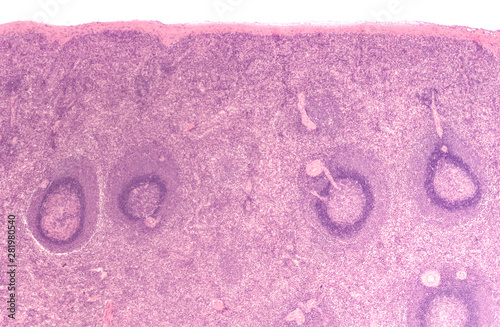 Histology of the human spleen, with red pulp and white pulp. photo
