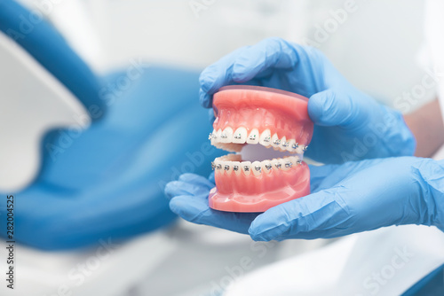 Dentist holding jaw model, orthodontics concept