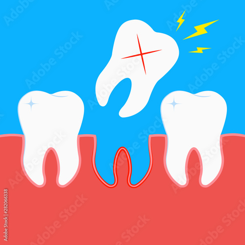 Teeth Loss Dental damage Pain Illustration Vector