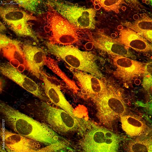 Localization of ceramides in human cultured skin cells. Real photo from a microscope. Photo may contain artifacts due to fluorescent staining.