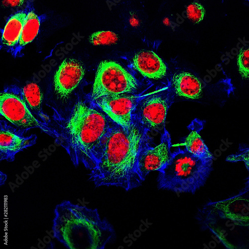 HeLa cells labeled with fluorescent dyes