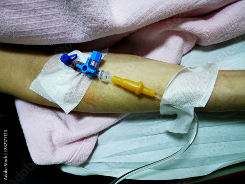 serum transfuse to arm at emergency room