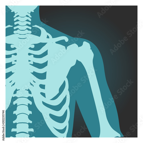 X-ray shot of shoulder, human body bones, radiography, rib cage, chest and arm, vector illustration.