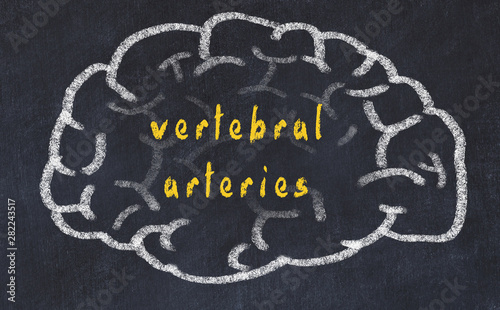 Drawind of human brain on chalkboard with inscription vertebral arteries photo