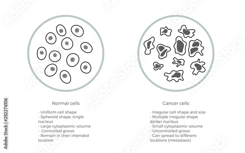 cell structure: normal and cancer photo