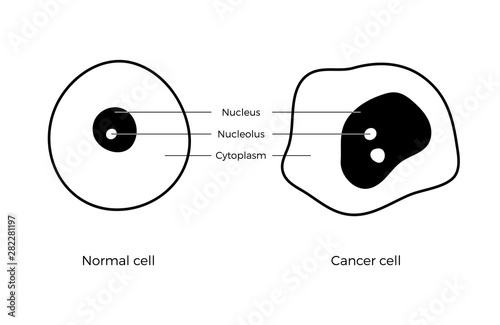 cell structure: normal and cancer