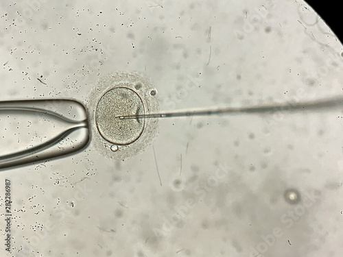 View through microscope at in vitro fertilization process © Andriy Bezuglov