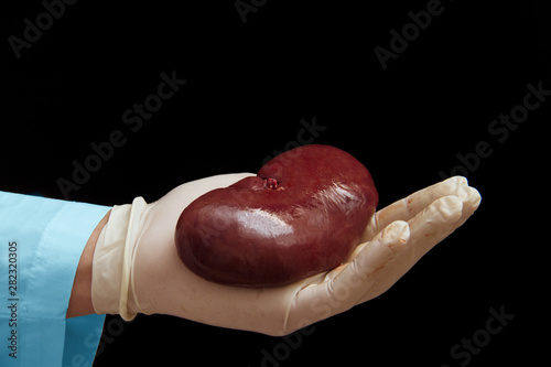 kidney transplant surgery concept. real kidney is in hands of transplant surgeon. cadaver, donor kidney. International Kidney Day Holiday.