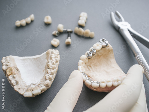 Dental prosthesis equipment tools. Two gypsum jaws dentures crowns and bone forceps on gray background. photo