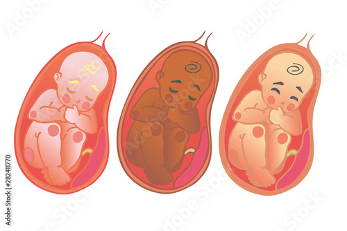 Fetal icon of different races, prenatal human child with placenta silhouette isolated on white background. Image of the baby and placenta inside the uterus. Design symbol of pregnancy.