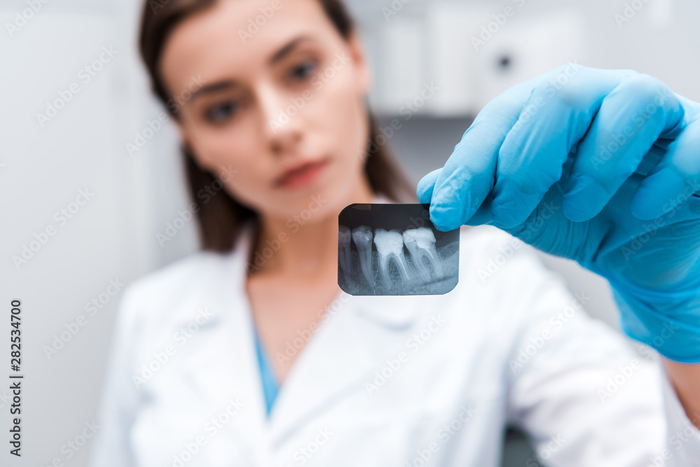 selective focus of x-ray in hand on attractive dentist selective focus of x-ray in hand on attractive dentist