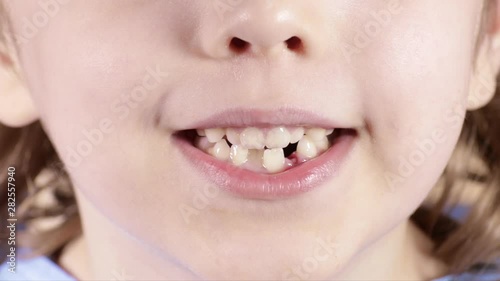 Smiling boy of six years breaths through the mouth. Closeup photo