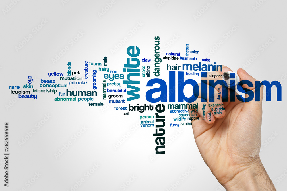 Albinism word cloud concept on grey background Albinism word cloud concept on grey background