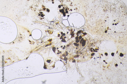 Spider mite under the microscope photo