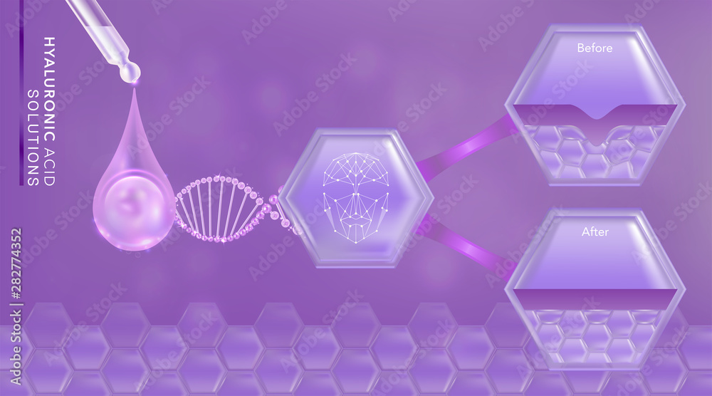 Hyaluronic acid before and after skin solutions ad, purple collagen serum drop with cosmetic advertising background ready to use, illustration vector. Hyaluronic acid before and after skin solutions ad, purple collagen serum drop with cosmetic advertising background ready to use, illustration vector.