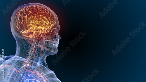 3d rendered illustration of  brain tumor and brain disease 3D illustration