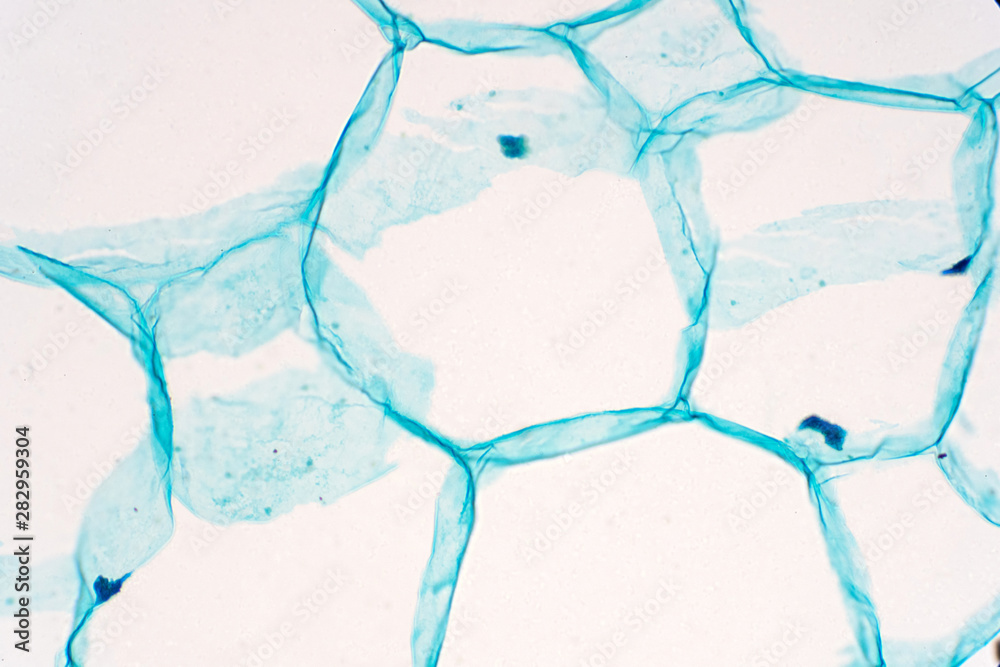 Cross sections of plant stem under microscope view show Structure of Parenchyma Cells. Cross sections of plant stem under microscope view show Structure of Parenchyma Cells.