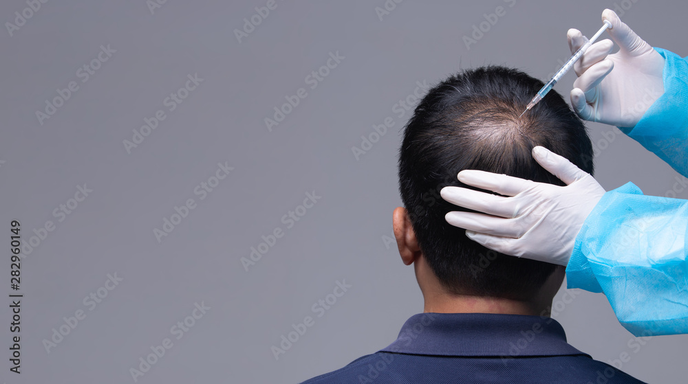 Aesthetics Doctor inject treatment serum vitamins to hair fall area on head by Syringe, Short Hair Loss control therapy clinic to prevent falling in working senior man woman, studio lighting isolated Stock Aesthetics Doctor inject treatment serum vitamins to hair fall area on head by Syringe, Short Hair Loss control therapy clinic to prevent falling in working senior man woman, studio lighting isolated Stock