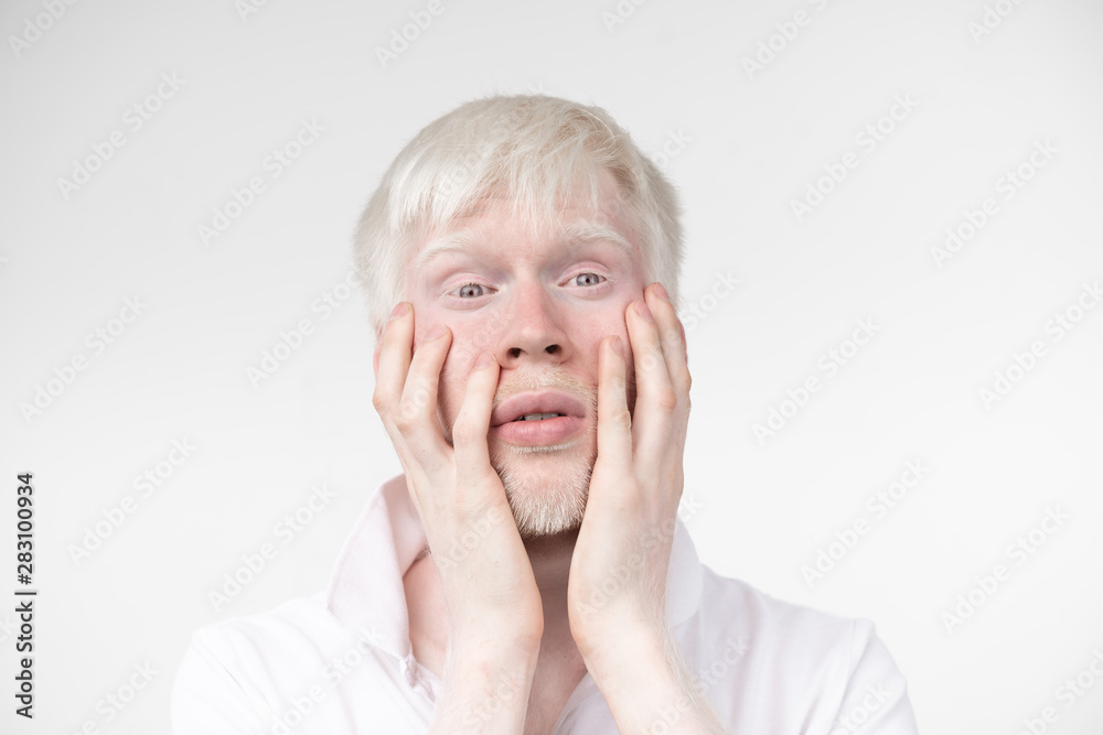 portrait of an albino man in studio dressed t-shirt isolated on a white background. abnormal deviations. unusual appearance portrait of an albino man in studio dressed t-shirt isolated on a white background. abnormal deviations. unusual appearance
