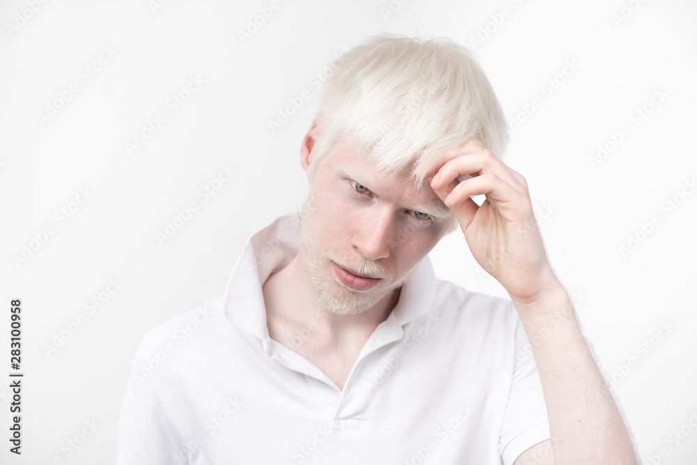 portrait of an albino man in studio dressed t-shirt isolated on a white background. abnormal deviations. unusual appearance portrait of an albino man in studio dressed t-shirt isolated on a white background. abnormal deviations. unusual appearance