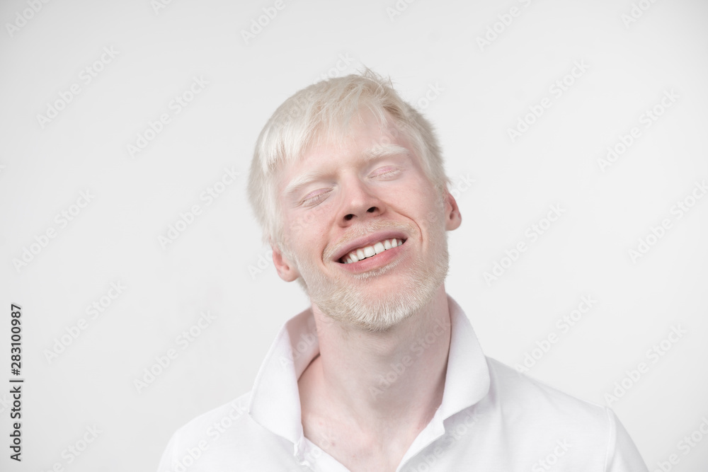 portrait of an albino man in studio dressed t-shirt isolated on a white background. abnormal deviations. unusual appearance portrait of an albino man in studio dressed t-shirt isolated on a white background. abnormal deviations. unusual appearance