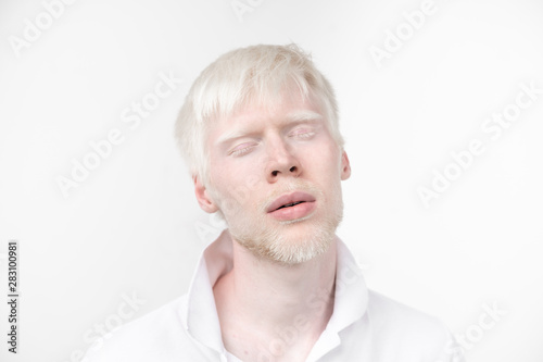 portrait of an albino man in  studio dressed t-shirt isolated on a white background. abnormal deviations. unusual appearance photo