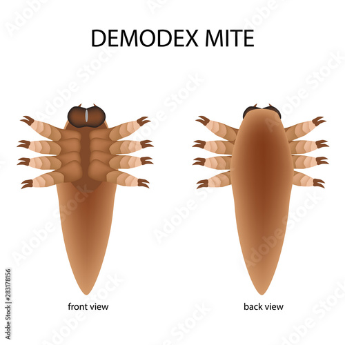 The structure of the demodex mite. Front view and rear view. Demodecosis. Infographics. Vector illustration on isolated background.