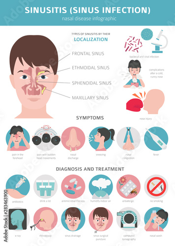 Nasal diseases. Sinusitis, sinus infection diagnosis and treatment medical infographic design