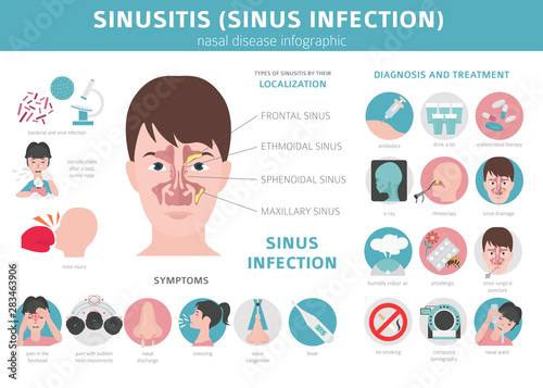 Nasal diseases. Sinusitis, sinus infection diagnosis and treatment medical infographic design photo