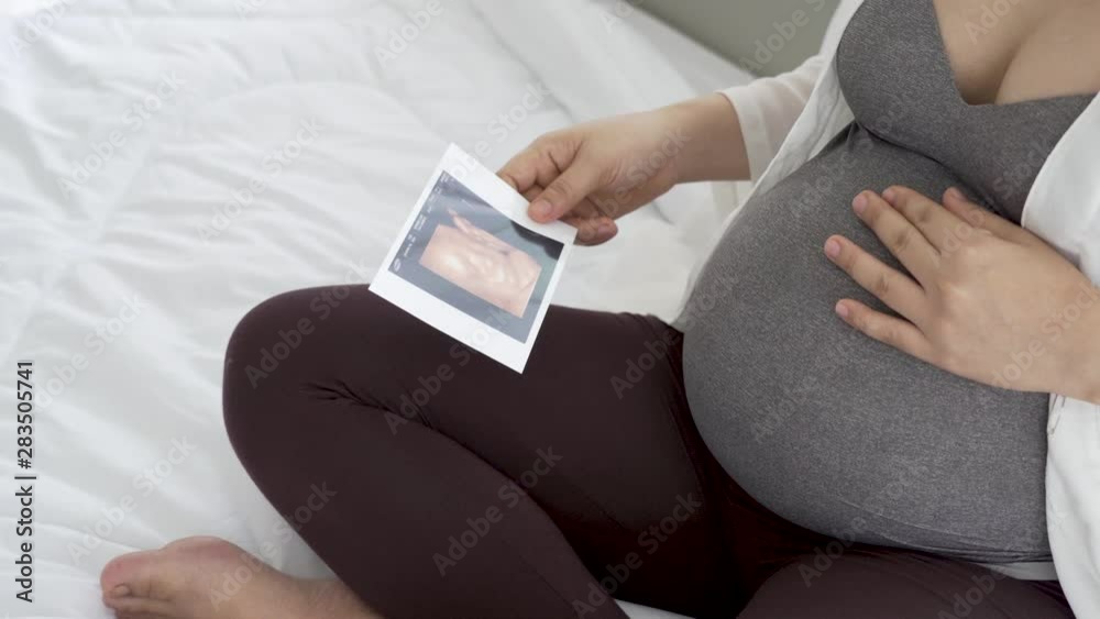 Pregnant women are viewing pictures of babies from ultrasound. Pregnant women are viewing pictures of babies from ultrasound.