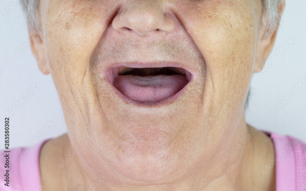 Toothless Mouth An Elderly Woman With No Teeth Old Granny With Her Mouth Open Photos Adobe