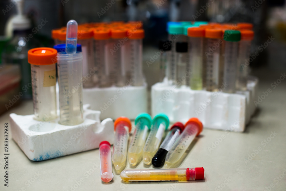 laboratory equipment pipette dropping sample into a test tube,abstract science background. laboratory equipment pipette dropping sample into a test tube,abstract science background.