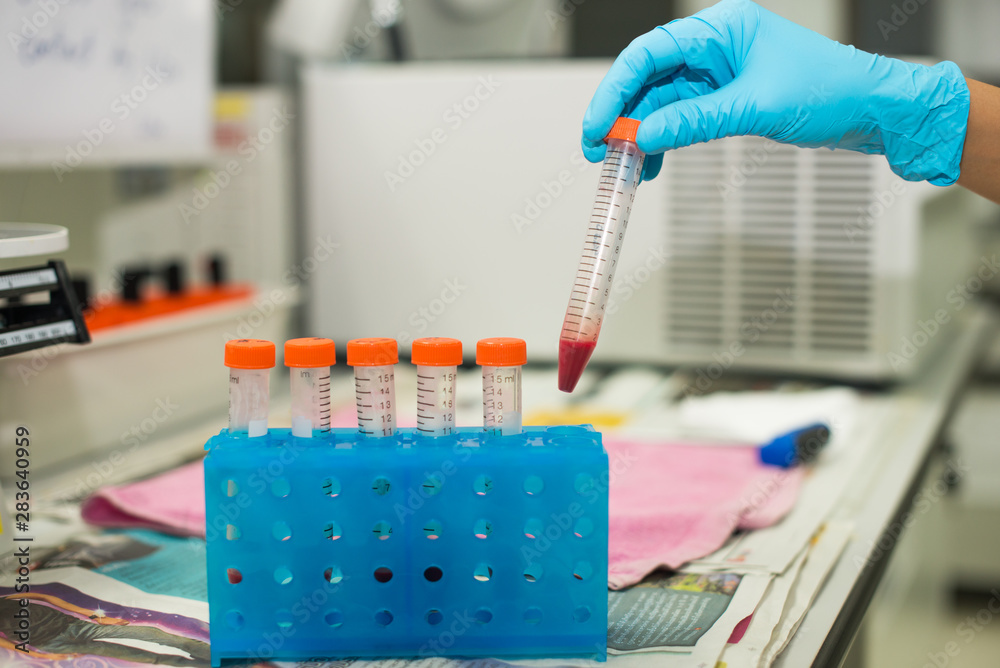 laboratory equipment pipette dropping sample into a test tube,abstract science background. laboratory equipment pipette dropping sample into a test tube,abstract science background.