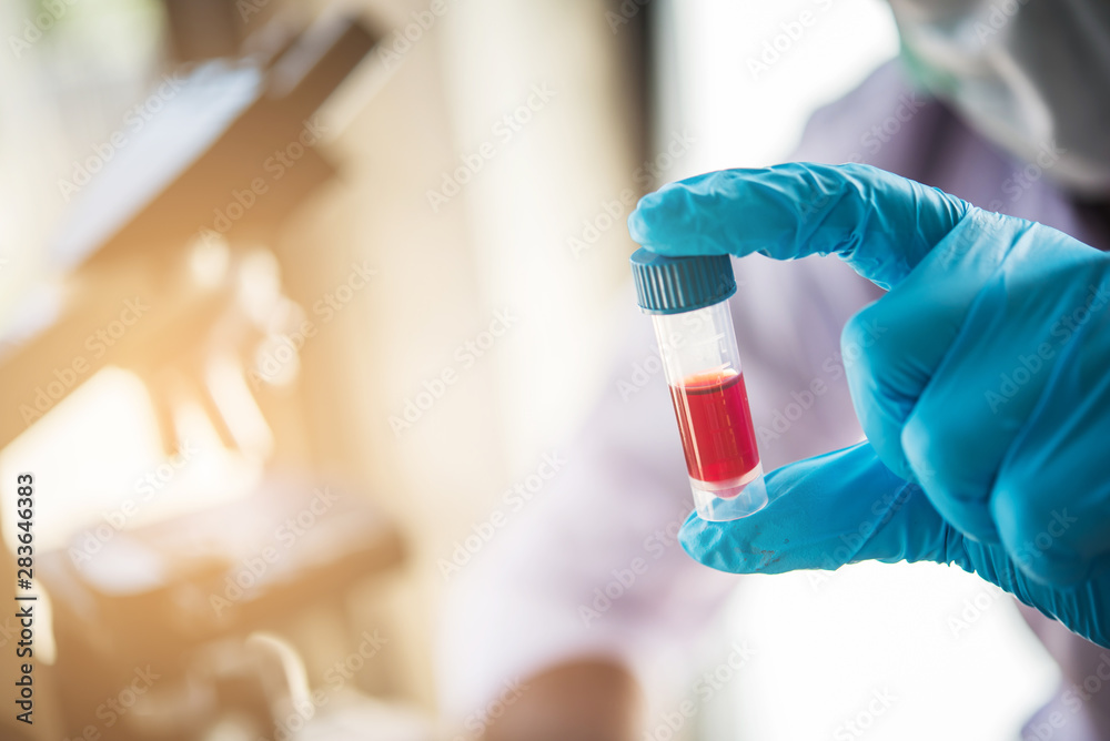 lab technician assistant analyzing a blood sample in test tube at laboratory. Medical, pharmaceutical and scientific research and development concept lab technician assistant analyzing a blood sample in test tube at laboratory. Medical, pharmaceutical and scientific research and development concept