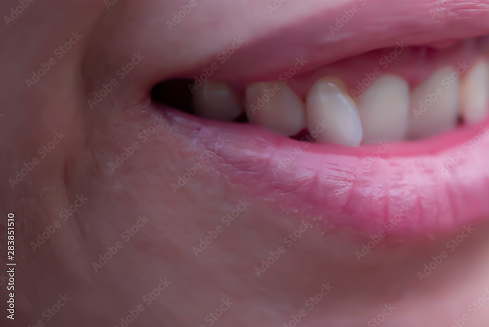 Obraz premium The front teeth can be seen while smiling.