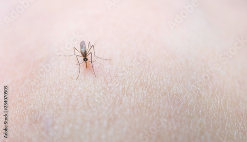 Mosquito sucking blood on human skin cause sick, Malaria,Dengue,Chikungunya,Mayaro fever,Dangerous Zica virus,influenza,Zika virus