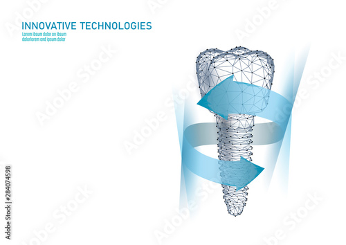Molar tooth dental implant 3d low poly geometric model. Dentistry innovation future technology titan metal thread. Medical health science polygonal point line vector illustration
