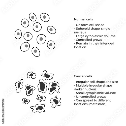 cell structure: normal and cancer