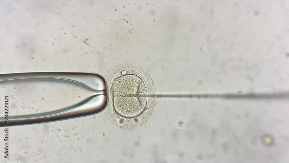 View through microscope at in vitro fertilization process Stock Video ...