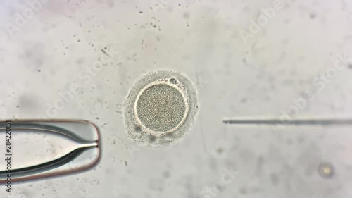 View through microscope at in vitro fertilization process