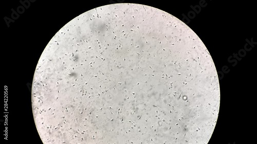 View at human sperm under microscope in lab