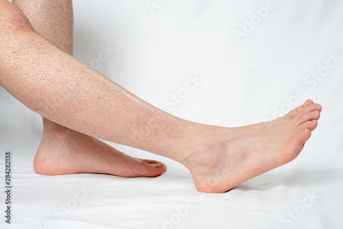 メンズ 除毛1週間後の脚 ムダ毛処理の面倒くささをイメージ © Taro
