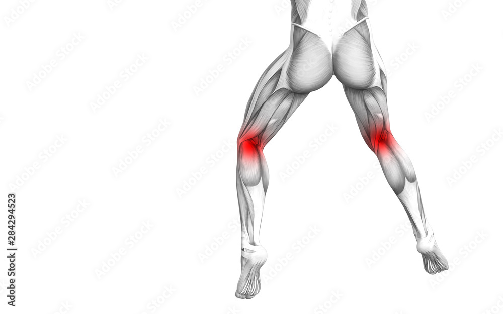 Conceptual knee human anatomy with red hot spot inflammation or articular joint pain for leg health care therapy or sport muscle concepts. 3D illustration man arthritis or bone osteoporosis disease Conceptual knee human anatomy with red hot spot inflammation or articular joint pain for leg health care therapy or sport muscle concepts. 3D illustration man arthritis or bone osteoporosis disease