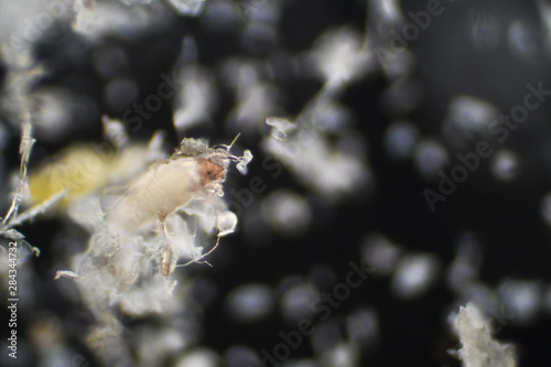 顕微鏡で拡大したハウスダストとダニの死骸